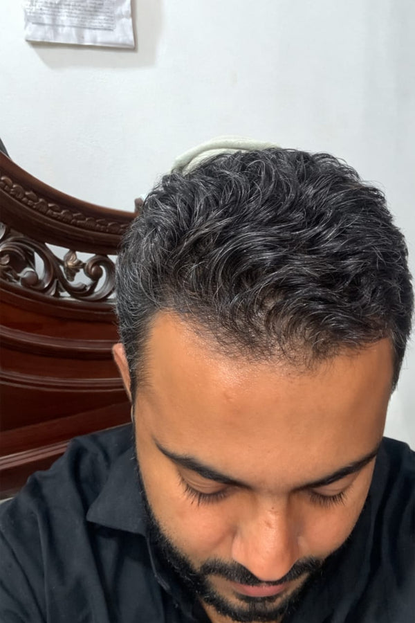 Before - Muhmmad Ahsan